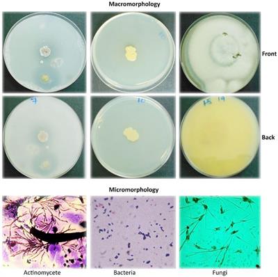 Degradation of polyethylene plastic bags and bottles using microorganisms isolated from soils of Morogoro, Tanzania